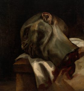 Imagem da pintura de Theodore Gericault, "Head of a Guillotined Man" em que temos a cabeça de um homem decapitada (assasinado)